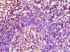 NRG1 / Heregulin / Neuregulin Antibody - Immunohistochemistry of paraffin-embedded human tonsil tissue using NRG1 Antibody at dilution of 1:100