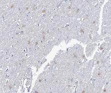 NRG1 / Heregulin / Neuregulin Antibody - 1:100 staining human brain tissue by IHC-P. The tissue was formaldehyde fixed and a heat mediated antigen retrieval step in citrate buffer was performed. The tissue was then blocked and incubated with the antibody for 1.5 hours at 22°C. An HRP conjugated goat anti-rabbit antibody was used as the secondary.