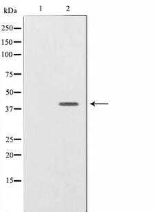 NRG1 / Heregulin / Neuregulin Antibody - Western blot analysis on SK-OV3 cell lysates using NRG1 isoform-10 antibody. The lane on the left is treated with the antigen-specific peptide.