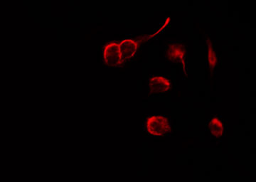 NRG1 / Heregulin / Neuregulin Antibody - Staining SK-OV3 cells by IF/ICC. The samples were fixed with PFA and permeabilized in 0.1% Triton X-100, then blocked in 10% serum for 45 min at 25°C. The primary antibody was diluted at 1:200 and incubated with the sample for 1 hour at 37°C. An Alexa Fluor 594 conjugated goat anti-rabbit IgG (H+L) Ab, diluted at 1/600, was used as the secondary antibody.