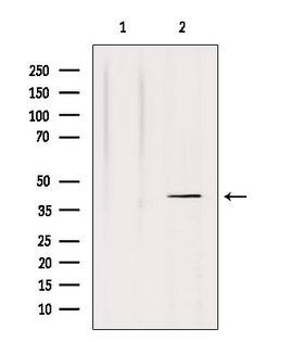 NRG1 / Heregulin / Neuregulin Antibody - Western blot analysis of extracts of HepG2 cells using NRG1 isoform-10 antibody. Lane 1 was treated with the antigen-specific peptide.
