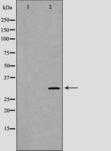 NRG1 / Heregulin / Neuregulin Antibody - Western blot analysis of MCF-7 lysate using NRG1 antibody. The lane on the left is treated with the antigen-specific peptide.