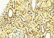 NRG1 / Heregulin / Neuregulin Antibody - 1:100 staining mouse kidney tissue by IHC-P. The sample was formaldehyde fixed and a heat mediated antigen retrieval step in citrate buffer was performed. The sample was then blocked and incubated with the antibody for 1.5 hours at 22°C. An HRP conjugated goat anti-rabbit antibody was used as the secondary.