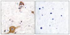 NRG1 / Heregulin / Neuregulin Antibody - Peptide - + Immunohistochemical analysis of paraffin-embedded human brain tissue using NRG1 isoform-10 antibody.