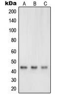 NRG1 / Heregulin / Neuregulin Antibody - Western blot analysis of Neuregulin SMDF expression in A431 (A); A673 (B); SKNMC (C) whole cell lysates.