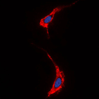 NRG1 / Heregulin / Neuregulin Antibody - Immunofluorescent analysis of Neuregulin SMDF staining in A431 cells. Formalin-fixed cells were permeabilized with 0.1% Triton X-100 in TBS for 5-10 minutes and blocked with 3% BSA-PBS for 30 minutes at room temperature. Cells were probed with the primary antibody in 3% BSA-PBS and incubated overnight at 4 C in a humidified chamber. Cells were washed with PBST and incubated with a DyLight 594-conjugated secondary antibody (red) in PBS at room temperature in the dark. DAPI was used to stain the cell nuclei (blue).