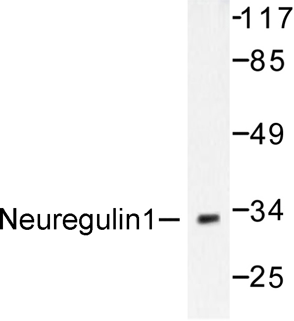 NRG1 / Heregulin / Neuregulin Antibody - Western blot of SMDF/Neuregulin 1 (Y4) pAb in extracts from SKOV3 cells.