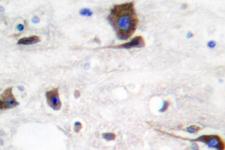 NRG1 / Heregulin / Neuregulin Antibody - IHC of SMDF/Neuregulin 1 (Y4) pAb in paraffin-embedded human brain tissue.