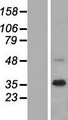 NRG1 / Heregulin / Neuregulin Protein - Western validation with an anti-DDK antibody * L: Control HEK293 lysate R: Over-expression lysate