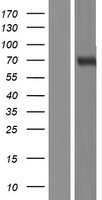 NRG1 / Heregulin / Neuregulin Protein - Western validation with an anti-DDK antibody * L: Control HEK293 lysate R: Over-expression lysate