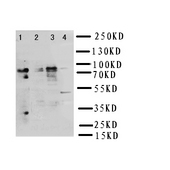 NRG2 Antibody - WB of NRG2 antibody. Lane 1: Rat Liver Tissue Lysate. Lane 2: COLO320 cell Lysate. Lane 3: SMMC cell Lysate. Lane 4: SW620 cell Lysate.