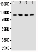 NRG2 Antibody - Anti-NRG2 antibody, Western blotting All lanes: Anti NRG2 at 0.5ug/ml Lane 1: Rat Liver Tissue Lysate at 50ug Lane 2: COLO320 Whole Cell Lysate at 40ug Lane 3: SMMC Whole Cell Lysate at 40ug Lane 4: SW620 Whole Cell Lysate at 40ug Predicted bind size: 91KD Observed bind size: 91KD