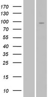 NRG2 Protein - Western validation with an anti-DDK antibody * L: Control HEK293 lysate R: Over-expression lysate