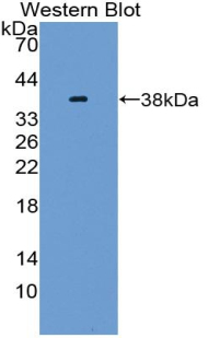 NRG4 Antibody - Western blot of recombinant NRG4.