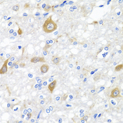 NRG4 Antibody - Immunohistochemistry of paraffin-embedded rat brain tissue.