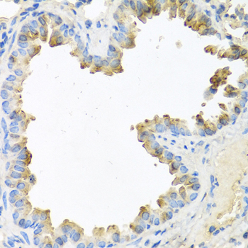 NRG4 Antibody - Immunohistochemistry of paraffin-embedded mouse lung tissue.