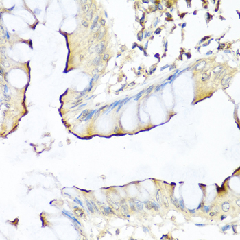 NRG4 Antibody - Immunohistochemistry of paraffin-embedded human colon tissue.