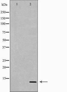 NRG4 Antibody - Western blot analysis of extracts of Recombinant protein using NRG4 antibody. The lane on the left is treated with the antigen-specific peptide.