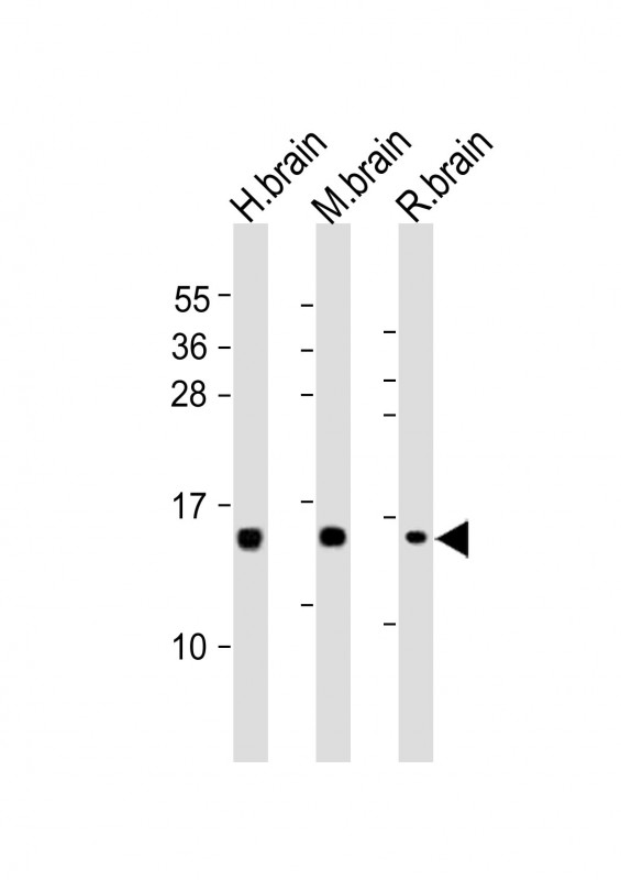 NRGN / Neurogranin Antibody - All lanes: Anti-NRGN Antibody (C-term) at 1:2000 dilution. Lane 1: human brain lysates. Lane 2: mouse brain lysates. Lane 3: rat brain lysates Lysates/proteins at 20 ug per lane. Secondary Goat Anti-Rabbit IgG, (H+L), Peroxidase conjugated at 1:10000 dilution. Predicted band size: 8 kDa. Blocking/Dilution buffer: 5% NFDM/TBST.