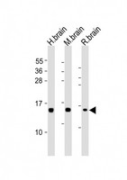 NRGN / Neurogranin Antibody - All lanes: Anti-NRGN Antibody (C-term) at 1:2000 dilution. Lane 1: human brain lysates. Lane 2: mouse brain lysates. Lane 3: rat brain lysates Lysates/proteins at 20 ug per lane. Secondary Goat Anti-Rabbit IgG, (H+L), Peroxidase conjugated at 1:10000 dilution. Predicted band size: 8 kDa. Blocking/Dilution buffer: 5% NFDM/TBST.