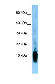 NRGN / Neurogranin Antibody - NRGN / Neurogranin antibody Western blot of Rat Brain lysate. Antibody concentration 1 ug/ml.  This image was taken for the unconjugated form of this product. Other forms have not been tested.