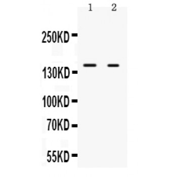 NRIP1 / RIP140 Antibody - RIP140 antibody Western blot. All lanes: Anti RIP140 at 0.5 ug/ml. Lane 1: Rat Liver Tissue Lysate at 50 ug. Lane 2: Mouse Liver Tissue Lysate at 50 ug. Predicted band size: 150 kD. Observed band size: 150 kD.