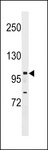 NRIP1 / RIP140 Antibody - RIP140 Antibody western blot of MCF-7 cell line lysates (35 ug/lane). The RIP140 antibody detected the RIP140 protein (arrow).