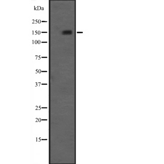 NRIP1 / RIP140 Antibody - Western blot analysis of NRIP1 expression in A498 (human Kidney Carcinoma) Whole cells Lysate. The lane on the left is treated with the antigen-specific peptide.