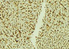 NRIP1 / RIP140 Antibody - 1:100 staining mouse liver tissue by IHC-P. The sample was formaldehyde fixed and a heat mediated antigen retrieval step in citrate buffer was performed. The sample was then blocked and incubated with the antibody for 1.5 hours at 22°C. An HRP conjugated goat anti-rabbit antibody was used as the secondary.