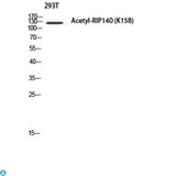 NRIP1 / RIP140 Antibody - Western Blot (WB) analysis of 293T using Acetyl-RIP140 (K158) antibody.
