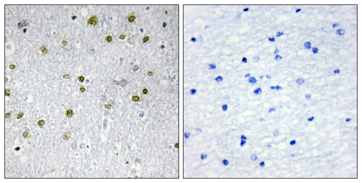 NRIP2 Antibody - Immunohistochemistry analysis of paraffin-embedded human brain tissue, using NRIP2 Antibody. The picture on the right is blocked with the synthesized peptide.
