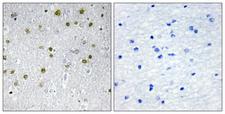 NRIP2 Antibody - Immunohistochemistry analysis of paraffin-embedded human brain tissue, using NRIP2 Antibody. The picture on the right is blocked with the synthesized peptide.