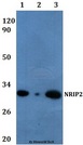 NRIP2 Antibody - Western blot of NRIP2 antibody at 1:500 Line1:HEK293T whole cell lysate Line2:H9C2 whole cell lysate Line3:sp20 whole cell lysate.