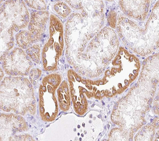 NRIP2 Antibody - 1:100 staining human kidney tissue by IHC-P. The tissue was formaldehyde fixed and a heat mediated antigen retrieval step in citrate buffer was performed. The tissue was then blocked and incubated with the antibody for 1.5 hours at 22°C. An HRP conjugated goat anti-rabbit antibody was used as the secondary.