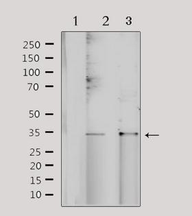 NRIP2 Antibody - Western blot analysis of extracts of various samples using NRIP2 antibody. Lane 1: 293 treated with blocking peptide; Lane 2: 293; Lane 3: HeLa;