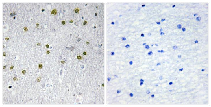 NRIP2 Antibody - Peptide - + Immunohistochemistry analysis of paraffin-embedded human brain tissue, using NRIP2 antibody.