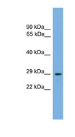 NRIP2 Antibody - NRIP2 antibody Western blot of Mouse Thymus lysate. This image was taken for the unconjugated form of this product. Other forms have not been tested.