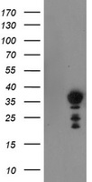 NRIP3 Antibody - HEK293T cells were transfected with the pCMV6-ENTRY control (Left lane) or pCMV6-ENTRY NRIP3 (Right lane) cDNA for 48 hrs and lysed. Equivalent amounts of cell lysates (5 ug per lane) were separated by SDS-PAGE and immunoblotted with anti-NRIP3.