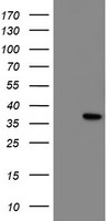 NRIP3 Antibody - HEK293T cells were transfected with the pCMV6-ENTRY control (Left lane) or pCMV6-ENTRY NRIP3 (Right lane) cDNA for 48 hrs and lysed. Equivalent amounts of cell lysates (5 ug per lane) were separated by SDS-PAGE and immunoblotted with anti-NRIP3.