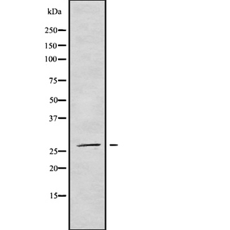 NRIP3 Antibody - Western blot analysis NRIP3 using COLO205 whole cells lysates