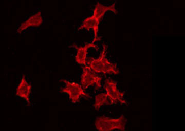 NRIP3 Antibody - Staining COLO205 cells by IF/ICC. The samples were fixed with PFA and permeabilized in 0.1% Triton X-100, then blocked in 10% serum for 45 min at 25°C. The primary antibody was diluted at 1:200 and incubated with the sample for 1 hour at 37°C. An Alexa Fluor 594 conjugated goat anti-rabbit IgG (H+L) Ab, diluted at 1/600, was used as the secondary antibody.