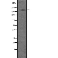 NRK Antibody - Western blot analysis of NRK expression in A549 cells line lysate. The lane on the left is treated with the antigen-specific peptide.