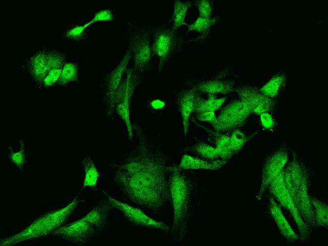 NRK Antibody - Immunofluorescence staining of NRK in U251MG cells. Cells were fixed with 4% PFA, permeabilzed with 0.1% Triton X-100 in PBS, blocked with 10% serum, and incubated with rabbit anti-Human NRK polyclonal antibody (dilution ratio 1:200) at 4°C overnight. Then cells were stained with the Alexa Fluor 488-conjugated Goat Anti-rabbit IgG secondary antibody (green). Positive staining was localized to Nucleus and Cytoplasm.