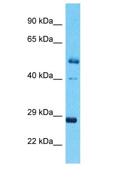 NRL Antibody - NRL antibody Western Blot of Esophagus Tumor. Antibody dilution: 1 ug/ml.  This image was taken for the unconjugated form of this product. Other forms have not been tested.