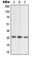 NRL Antibody - Western blot analysis of NRL expression in HEK293T (A); SP2/0 (B); PC12 (C) whole cell lysates.