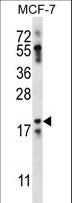 NRN1L Antibody - NRN1L Antibody western blot of MCF-7 cell line lysates (35 ug/lane). The NRN1L antibody detected the NRN1L protein (arrow).