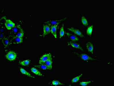 NRN1L Antibody - Immunofluorescent analysis of Hela cells using NRN1L Antibody at dilution of 1:100 and Alexa Fluor 488-congugated AffiniPure Goat Anti-Rabbit IgG(H+L)