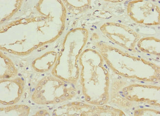 NRN1L Antibody - Immunohistochemistry of paraffin-embedded human kidney tissue using NRN1L Antibody at dilution of 1:100