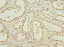 NRN1L Antibody - Immunohistochemistry of paraffin-embedded human kidney tissue using NRN1L Antibody at dilution of 1:100