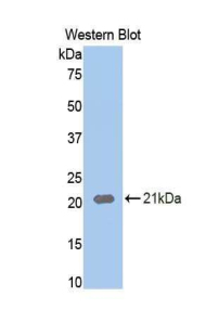 NRP1 / Neuropilin 1 Antibody - Western blot of recombinant NRP1 / Neuropilin 1.  This image was taken for the unconjugated form of this product. Other forms have not been tested.